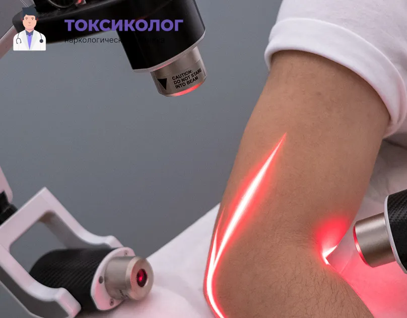 Лазерное оборудование для кодирования в клинике Токсиколог. Детальное фото кодирования лазером, крупный план лазерного луча и оборудования.